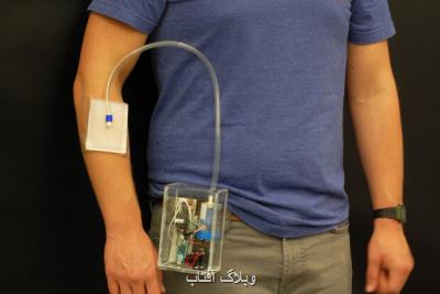 پژوهشگر ایرانی دستگاه درمان زخم با ازن ابداع كرد