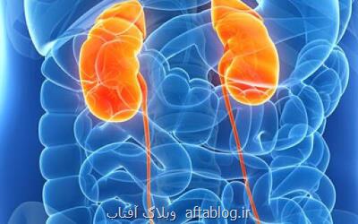 راهی جدید برای پیش گیری از بروز بیماری های كلیوی
